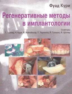 Скачать Регенеративные Методы в Имплантологии Кури